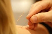 Akupunktur in der Schmerztherapie