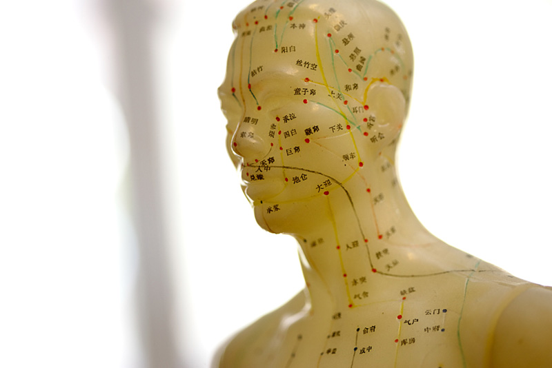 Akupunktur